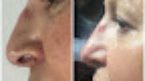 UK’s Five Star DermBeau Medical Aesthetics Comes To Lagos And Abuja